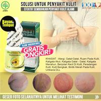 Gambar Obat Borok Di Kepala Tradisional,Pembasmi Jamur Pada Kulit,Bisul,Budug dari Ria Herbal Official undefined 1 Tokopedia