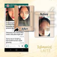 Gambar Acne Day Cream Laite Skincare / Krim Pagi Jerawat BPOM MUI dari laitestore undefined 3 Tokopedia