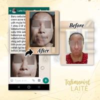 Gambar Laite Essential Paket Acne Series / Skincare Jerawat BPOM Halal MUI dari laitestore undefined 3 Tokopedia