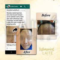Gambar Laite Essential Paket Acne Series / Skincare Jerawat BPOM Halal MUI dari laitestore undefined 4 Tokopedia