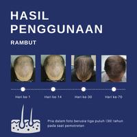 Gambar ROEGAN Minoxidil 5% - Penumbuh Rambut Brewok (untuk Botak & Rontok) - 30mL Basic dari ROEGAN undefined 5 Tokopedia