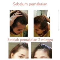 Gambar Hair Tonic Ginseng Bio Herbal Organik Vitamin Penyubur Rambut Rontok dari Zahrani Golden Store undefined 3 Tokopedia