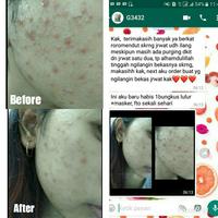 Gambar RORO MENDUT MASKER BROTOWALI ANTI JERAWAT BOPENG KOMEDO 40gr dari RoroMendut undefined 5 Tokopedia