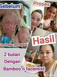 Gambar MSI FACEMIST FACE MIST ORIGINAL dari Mimibaby undefined 4 Tokopedia