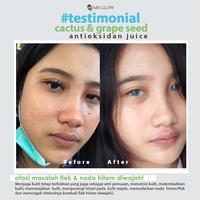 Gambar MS GLOW BALM JUICE YUZU/CACTUS/GRAPSEED/WATERMELON dari Rinchan Store undefined 3 Tokopedia