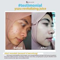 Gambar MS GLOW BALM JUICE YUZU/CACTUS/GRAPSEED/WATERMELON dari Rinchan Store undefined 5 Tokopedia