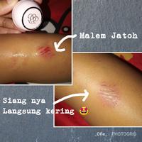 Gambar Tandercare multifungsi crime luka, pelembab kulit & bibir dari zahra azka store undefined 3 Tokopedia