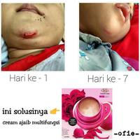 Gambar Tandercare multifungsi crime luka, pelembab kulit & bibir dari zahra azka store undefined 4 Tokopedia