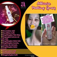 Gambar alluvia peeling spray dari ziahzee undefined 4 Tokopedia