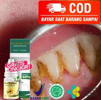 Gambar Obat Pembersih Karang Gigi, Pemutih Gigi Kuning & Hitam dari Khal Herbal undefined 1 Tokopedia