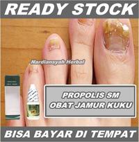 Gambar Obat Jamur Kuku, Infeksi Jamur Kuku, Salep Jamur Kuku di Tangan & Kaki dari azqiaraherbal undefined 1 Tokopedia