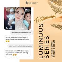 Gambar Paket luminous series ms glow dari Ms Glow Surabaya77 undefined 2 Tokopedia