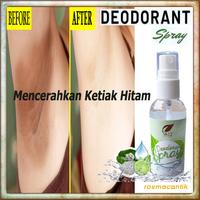 Gambar DEODORANT TAWAS SR12 - MEMUTIHKAN KETIAK HITAM - ANTI BAU BADAN dari Rosma Cantik undefined 1 Tokopedia