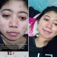 Gambar VAVL BEAUTY WATER ORI BY VIVALENTINE dari rumahtristan undefined 5 Tokopedia