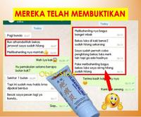 Gambar Krim Obat Penghilang Bekas Luka Bakar Koreng Cacar Hitam Merah Ampuh dari Obilo Store undefined 4 Tokopedia
