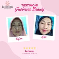 Gambar JUSTMINE BEAUTY SKINCARE ACNE MORE Paket Perawatan Wajah Jerawat dari unlimitlife undefined 3 Tokopedia
