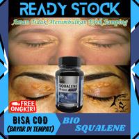 Gambar Obat Xanthelasma Gumpalan Lemak Mata, Xantelasma, Cream Xanthelasma dari Uzi-Herbal undefined 1 Tokopedia