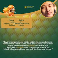 Gambar Obat salep cacar air cacar api cenang budug Obat Propolis SM Asli 100% dari Nafiza herbal undefined 2 Tokopedia