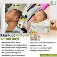 Gambar Obat lidah putih bayi/Obat Ampuh Sariawan /Obat Herbal/ BPOM aman bayi - VCO100ml dari Novi Agen SR12 Herbal undefined 2 Tokopedia