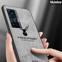 Gambar Case Vivo X70 Pro Deer Softcase - Biru dari EMAS JAYA ACC undefined 5 Tokopedia
