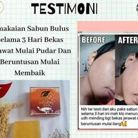 Gambar SABUN BULUS SR12 WAJAH DAN BADAN BPOM AMAN BUMIL DAN BUSUI GLOWING dari SR12 HERBAL BREBES undefined 2 Tokopedia