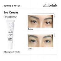Gambar Whitelab Eye Cream dari REGSMAKEUP undefined 5 Tokopedia