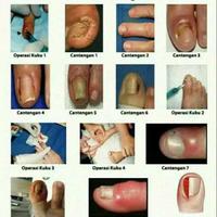Gambar obat cantengan paling ampuh super green plus jk-7 dari mefafa77 undefined 3 Tokopedia