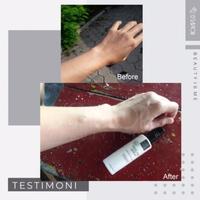 Gambar DSavior Peeling Spray Pembersih Badan Penghilang Daki Ampuh DISCOUNT dari Biliva undefined 2 Tokopedia