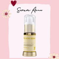 Gambar OXY SERUM ACNE dari Oxy Glow Original undefined 1 Tokopedia