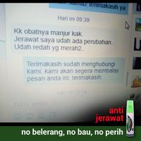 Gambar Obat Jerawat Batu Spray - Dermazits 25ml dari kozozo undefined 4 Tokopedia