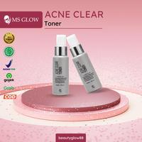 Gambar MS Glow New Acne Toner dari WAROENGGEULIS undefined 2 Tokopedia