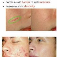 Gambar PAKET SET ALAT KECANTIKAN DERMAROLLER DENGAN SERUM DAN ANASTESI - 1mm dari Ukhtidotid undefined 2 Tokopedia