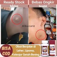 Gambar Obat Benjolan Di Leher - Lipoma - Kelenjar Getah Bening - Garlic Black dari JOBA STORE undefined 1 Tokopedia