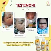 Gambar VCO SR12 ORIGINAL / VICO OIL / MINYAK VCO / MINYAK KELAPA MURNI - 1OOML dari SR12 REMBANG JAWA TENGAH undefined 3 Tokopedia