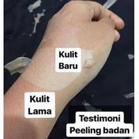 Gambar Peeling 30% PEMUTIH BADAN | Keranjang Khusus Peeling Bibit Pemutih dari Lucky Glow22 undefined 5 Tokopedia