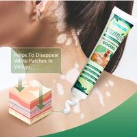 Gambar paket salep vitiligo original uji klinis ampuh untuk bercak putih dari yiganerjing_aslichina undefined 2 Tokopedia