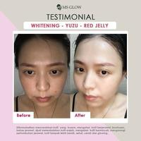 Gambar Ms Glow Paket Wajah Whitening Original free Pouch dari Elcony undefined 2 Tokopedia