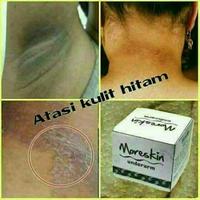 Gambar Promo Moreskin Underarm Cream Pencerah Kulit Asli Unarm Nasa dari NasaOfficial undefined 4 Tokopedia