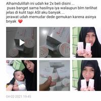 Gambar Nano plus collagen 100%hydrolized fish collagan mengatasi bopeng dari Somebymiofficial undefined 3 Tokopedia