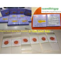 Gambar HOKI - Plester Kutil / Mata ikan / Kapalan ( Ji Yan Gao ) dari imanuel_store5 undefined 2 Tokopedia