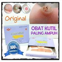 Gambar HOKI - Plester Kutil / Mata ikan / Kapalan ( Ji Yan Gao ) dari imanuel_store5 undefined 4 Tokopedia