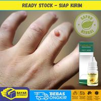 Gambar Obat Perontok Kutil, Daging Tumbuh / Daging Jadi, Propolis SM dari Fuji Herbal Shop undefined 1 Tokopedia