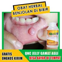 Gambar Obat Benjolan Di Bibir / Lidah - Mucocele - Kista - QnC Jelly Gamat dari Berkah Walatra Chanel undefined 1 Tokopedia