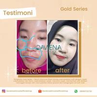 Gambar PAKET DARK SPOT GOLD SERIES DAVIENA SKINCARE ( ORIGINAL ) dari davienaskincareofficialshop undefined 4 Tokopedia