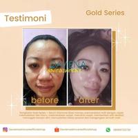 Gambar PAKET DARK SPOT GOLD SERIES DAVIENA SKINCARE ( ORIGINAL ) dari davienaskincareofficialshop undefined 2 Tokopedia