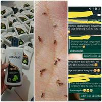 Gambar SHANAS SHAMPOO NASA ANTI KUTU SAMPO OBAT KUTU RAMBUT ORIGINAL - SRIT/SISIR KUTU dari GROSIR NASA ORIGINAL undefined 2 Tokopedia