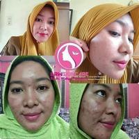 Gambar paket radiant acne drwskincare/ krim jerawat dari Drwskincare Jabodetabek undefined 5 Tokopedia