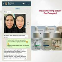Gambar Serum magic xpert dari GLOSKIN CLINIC SURABAYA undefined 3 Tokopedia
