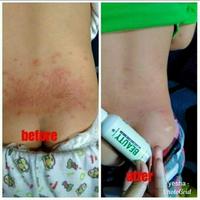 Gambar natura beauty spray - 45 ml dari bismillah_99 undefined 2 Tokopedia
