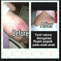 Gambar natura beauty spray - 45 ml dari bismillah_99 undefined 3 Tokopedia